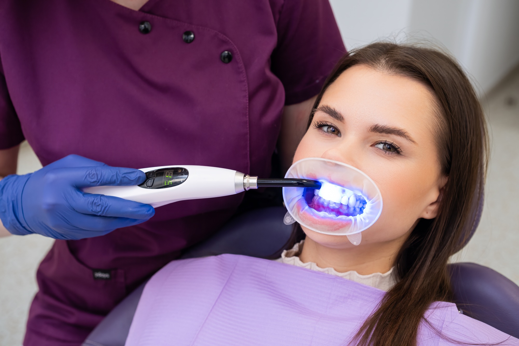 Dentist employs a UV lamp to cure the fillings in the patients teeth